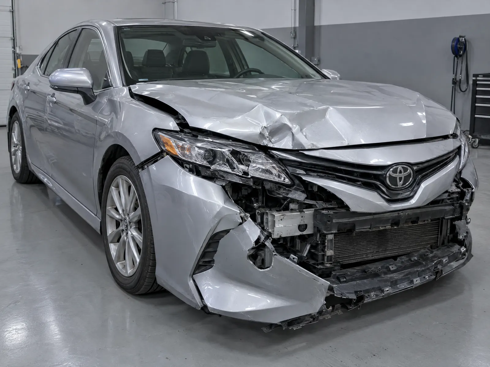 Before repair: Sedan · front-end collision